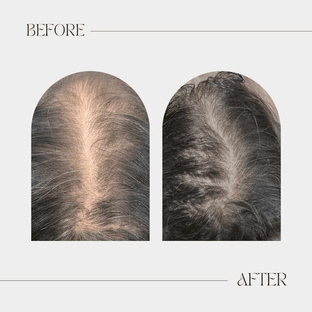 The Root Reset Membership 